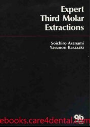 Expert third molar extractions (pdf)